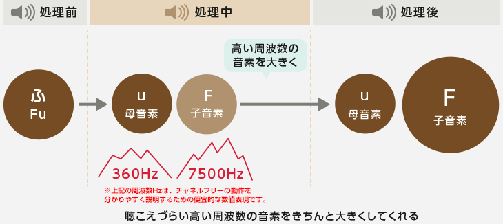 アクトス補聴器NR　チャネルフリー処理